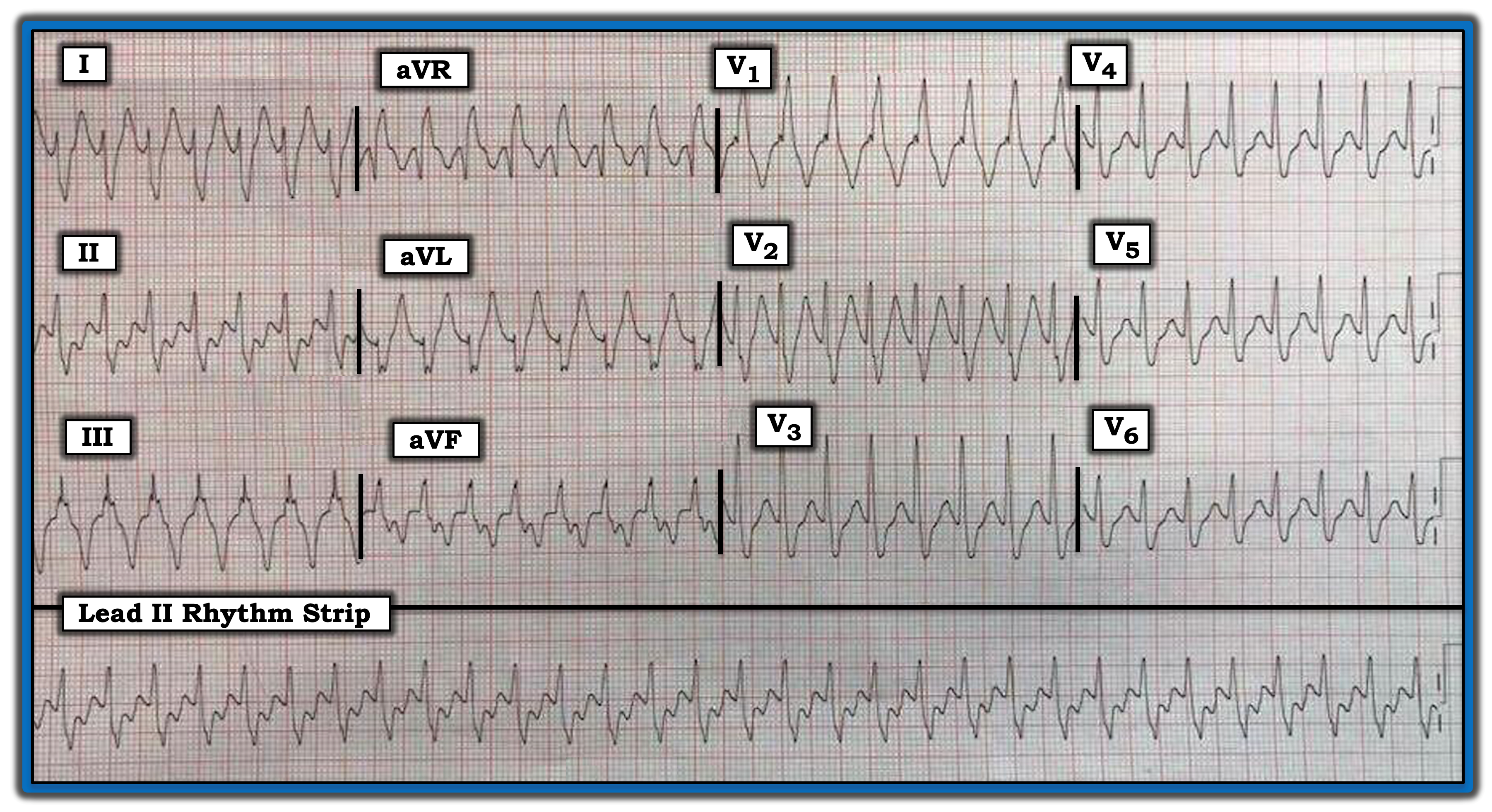 ECG Review Figure Nov. 15, 2023, IM